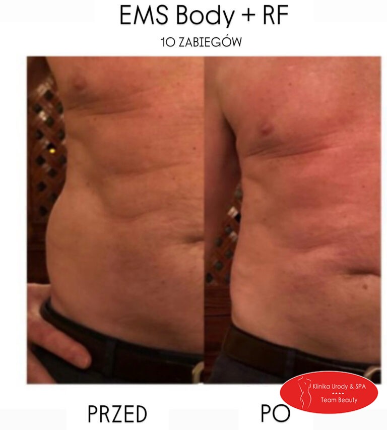 EMS Body